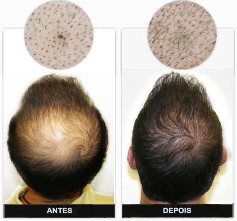 Calvimax DESBLOQUEIE SEU CRESCIMENTO CAPILAR